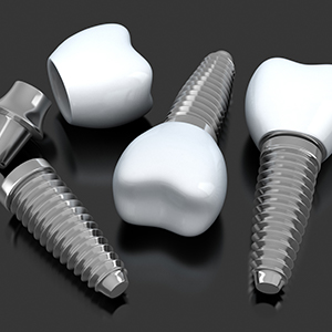 Animated dental implant supported crowns