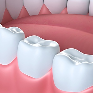 Animation of treated smiles