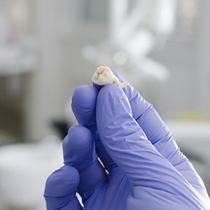 Hand holding an extracted tooth